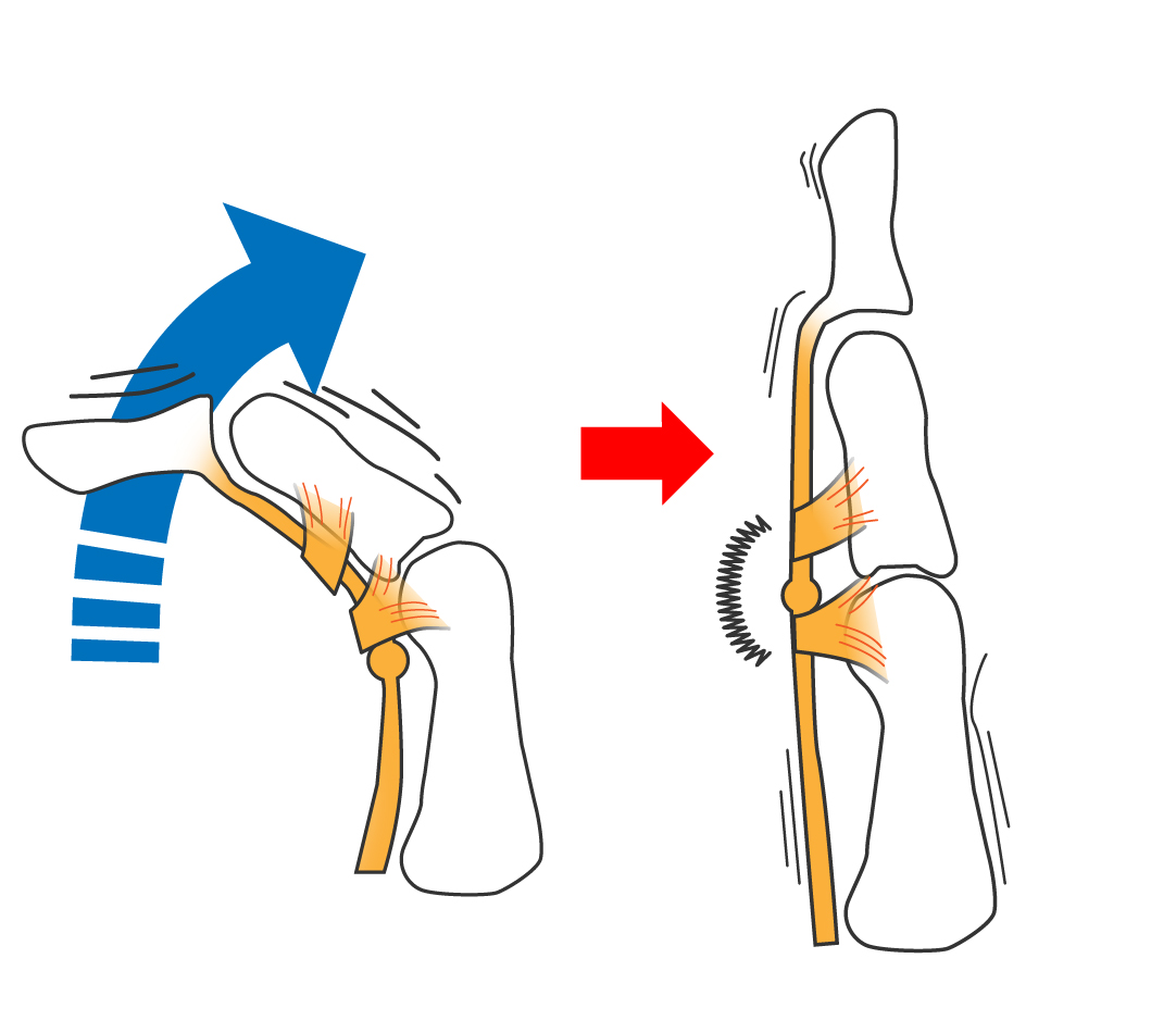 ばね指の専門ケアなら川崎の整骨院へ 画像